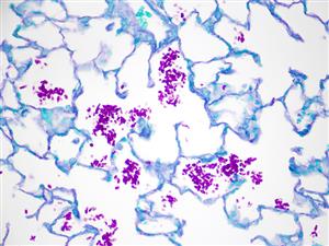 4233A | Control Slides:Histopathology; Fungus, PAS, Candida sp., Artificial